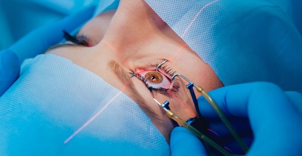 Woman's eyes are being pried open to allow a surgical laser into her pupil.