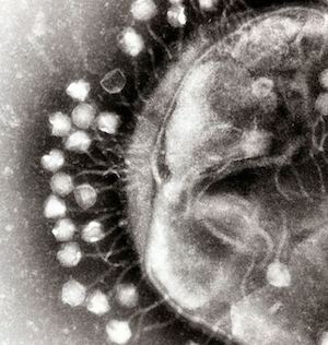 Mircoscopic image of bacteria