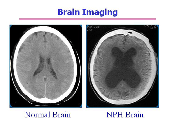 Imágenes Cerebrales