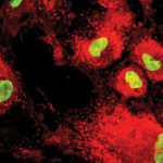 Mesenchymal Stem Cells