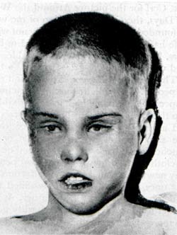This post-mortem photo appeared on 400,000 flyers distributed across the nation.