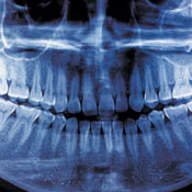 Teeth xray