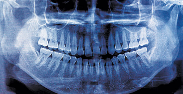 Teeth xray