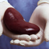 A physician holds a kidney