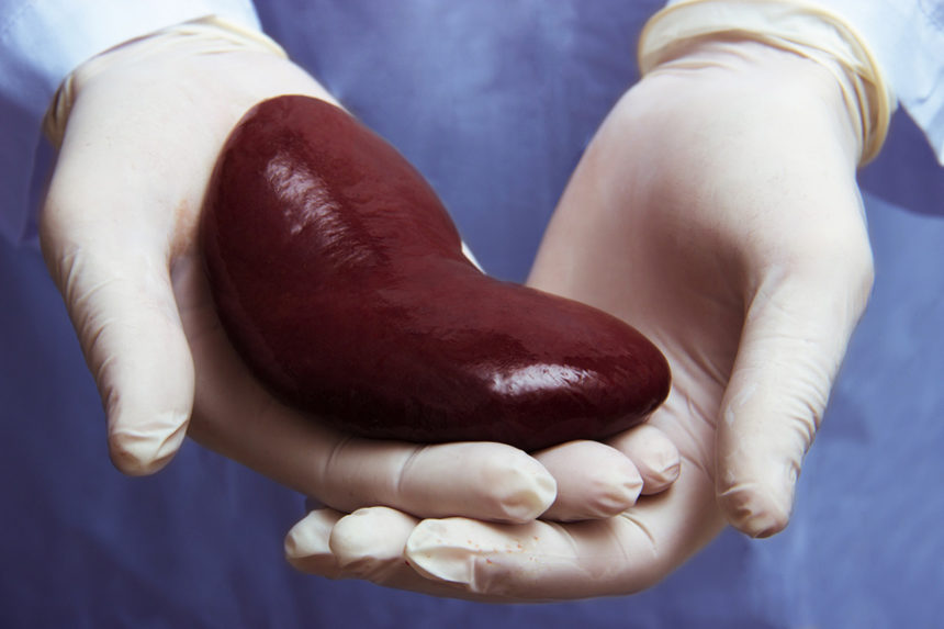 A physician holds a kidney