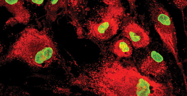 Mesenchymal Stem Cells