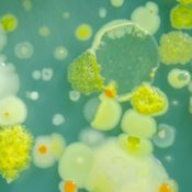 Bad stuff under a mircoscope